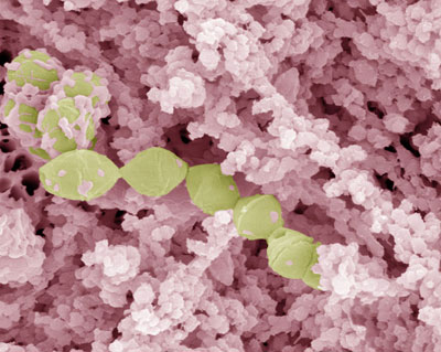 nanoparticules